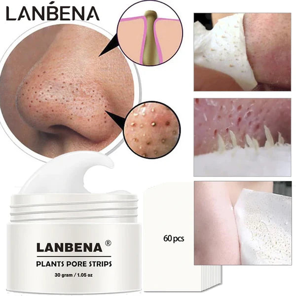 KIT LANBENA™ Eliminador de puntos negros + 60 toallitas removedoras